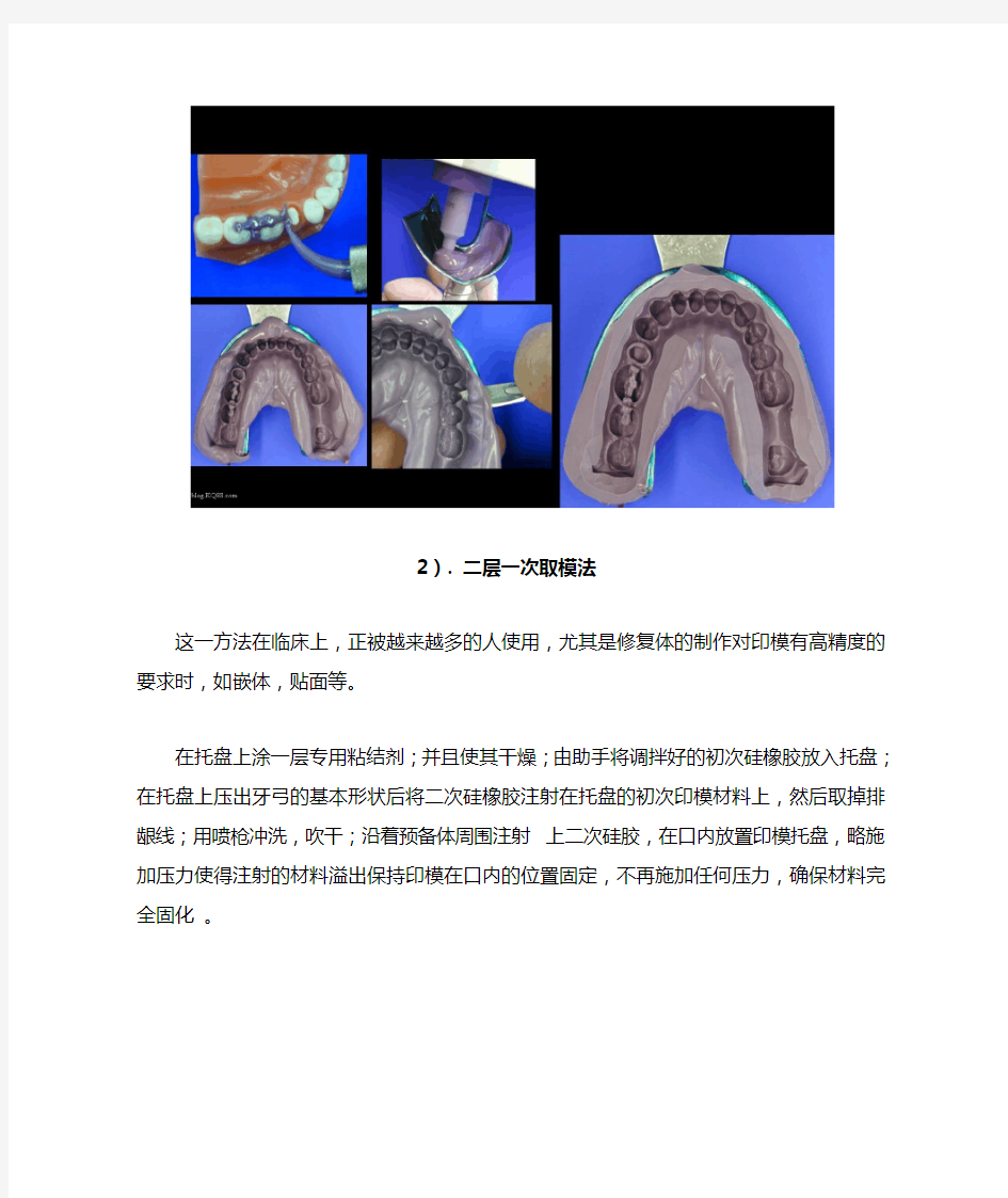 如何取得口腔精细印模(一)