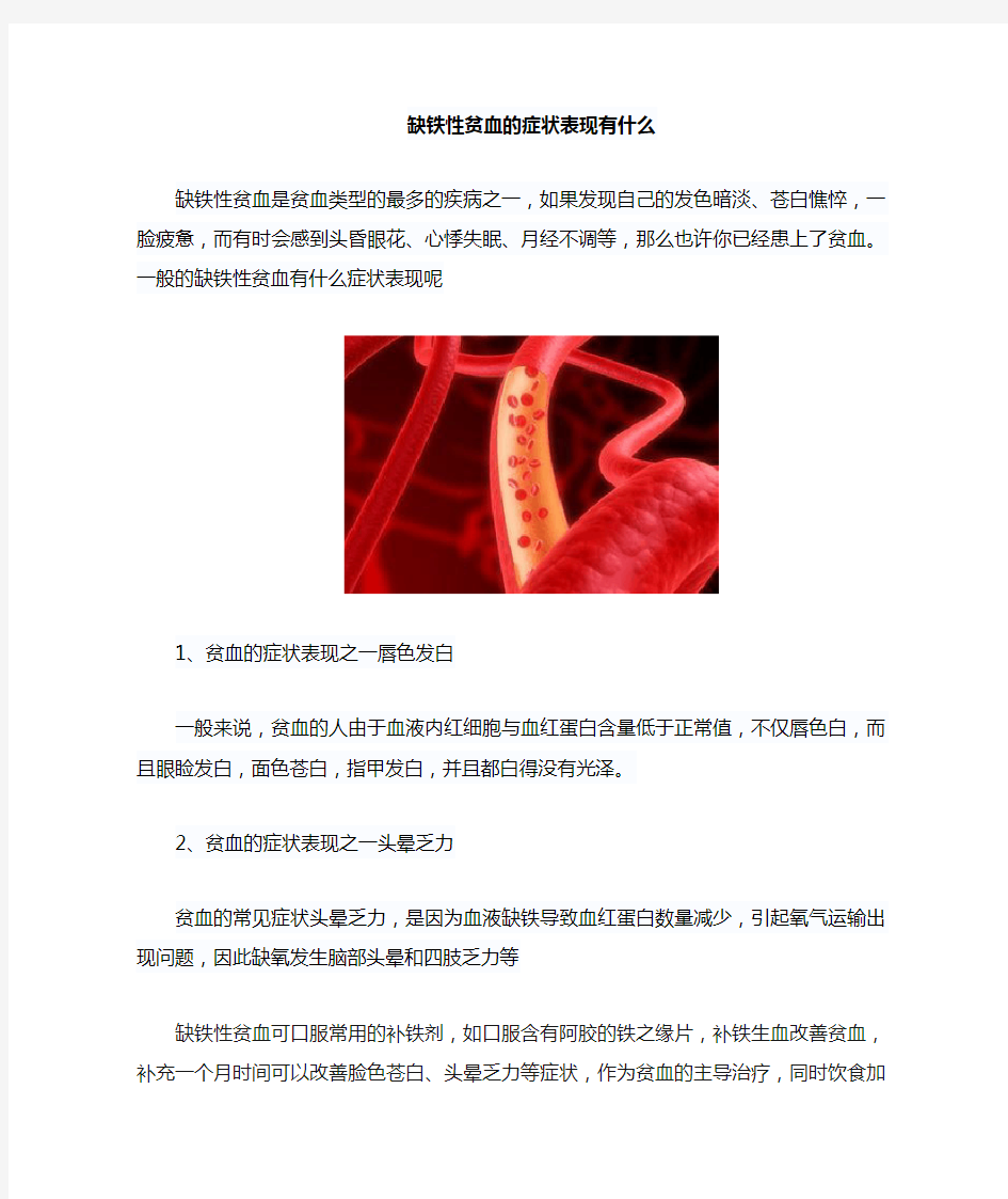 缺铁性贫血的症状表现