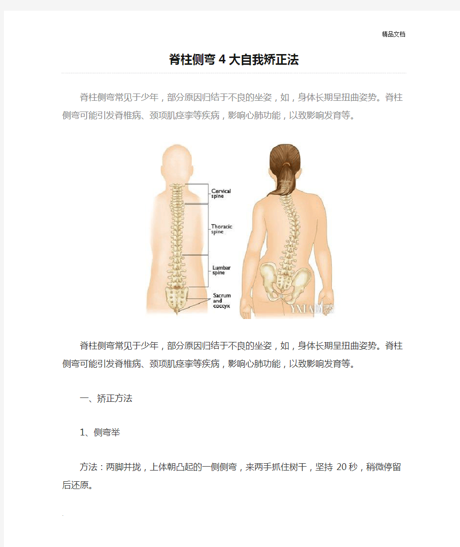 脊柱侧弯4大自我矫正法