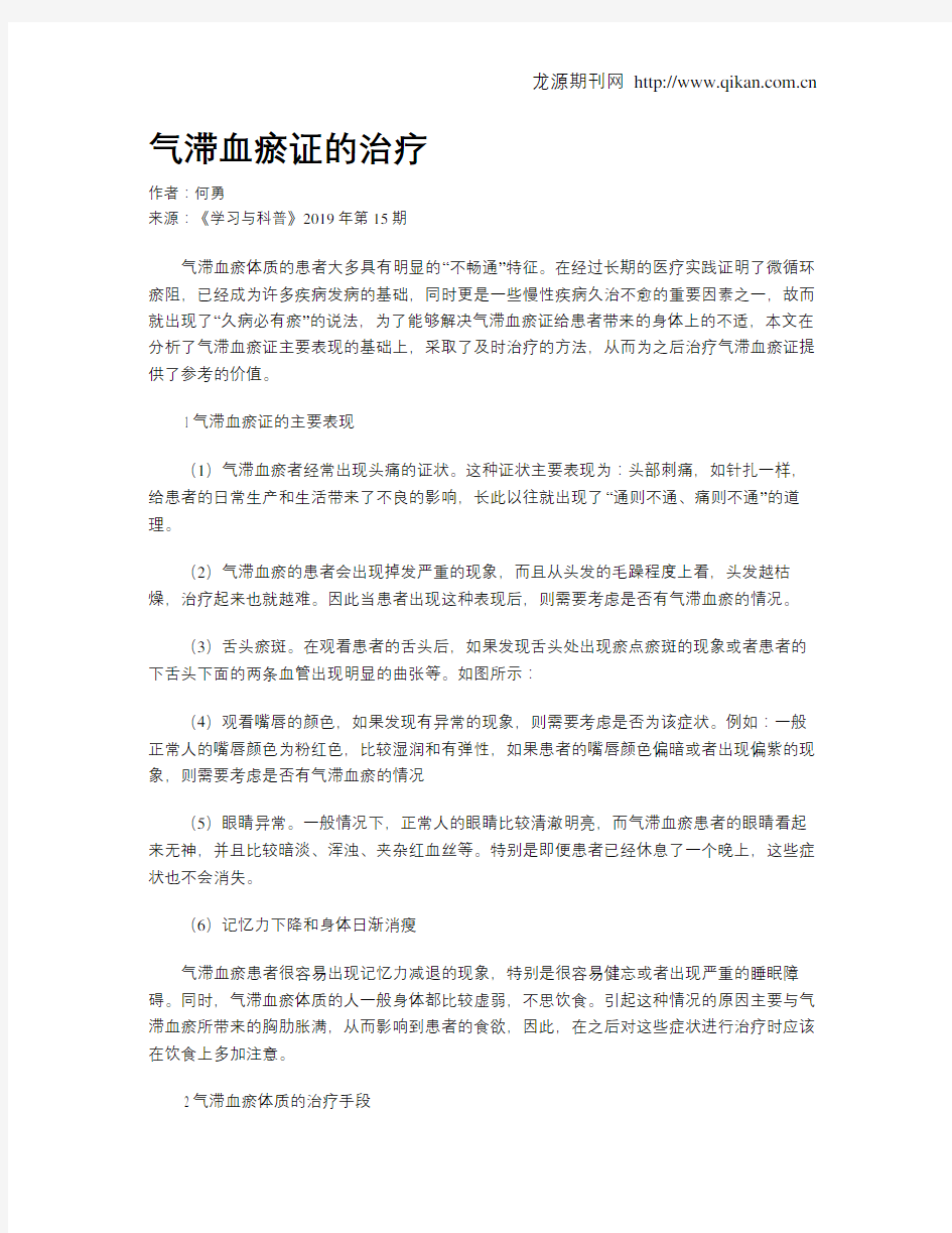 气滞血瘀证的治疗