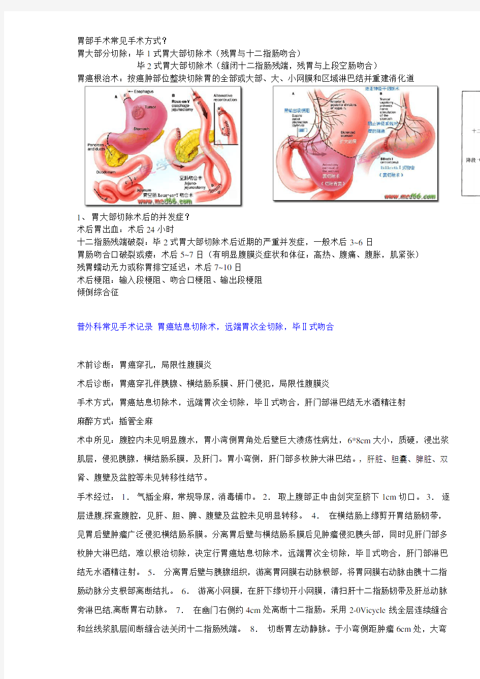 普外科所有手术记录