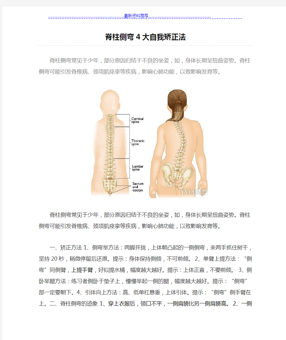 脊柱侧弯4大自我矫正法