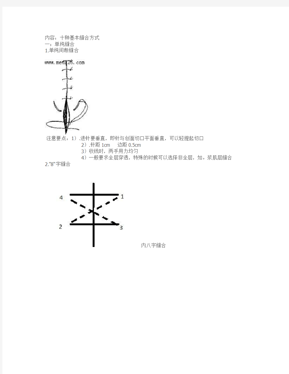 外科缝合