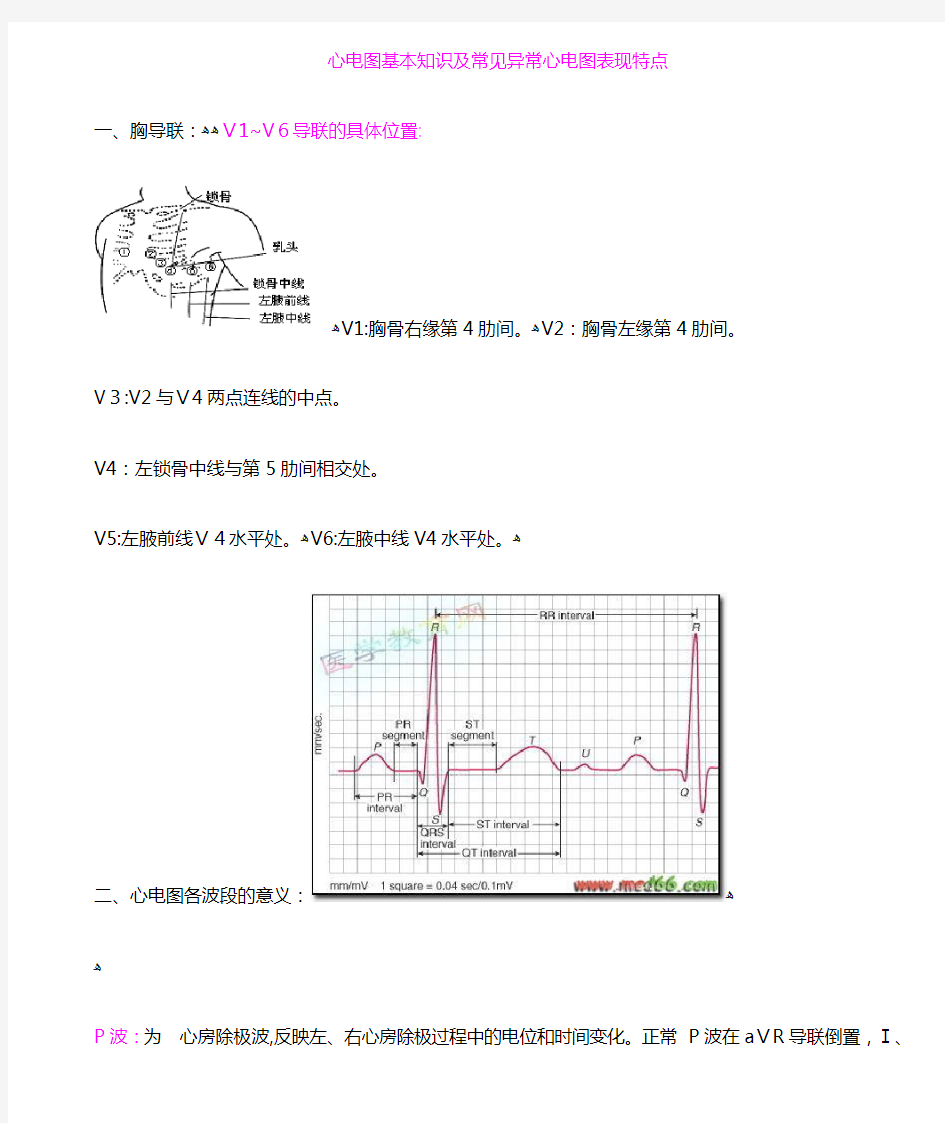 心电图基本知识及常见异常心电图表现