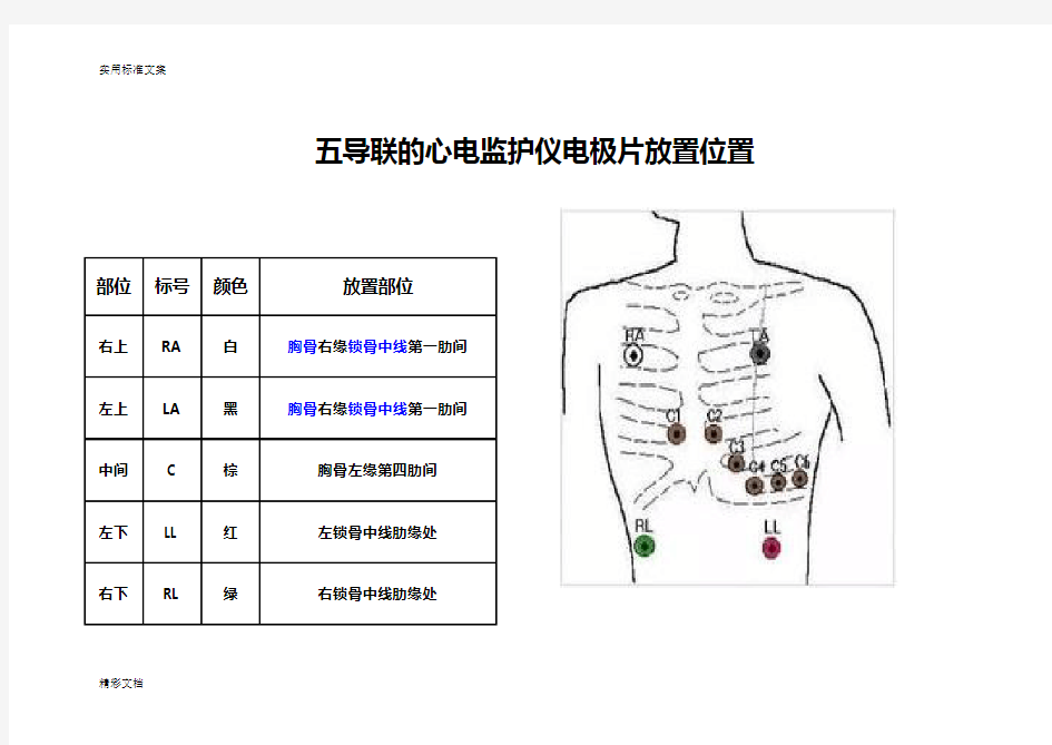 五导联地心电监护仪电极片放置位置