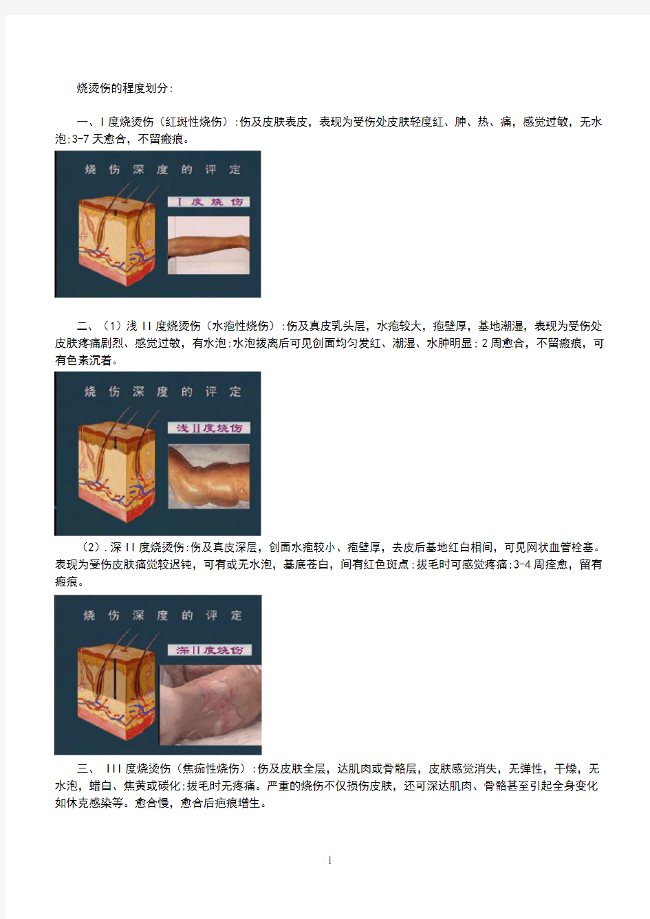 烧烫伤的程度划分中英文