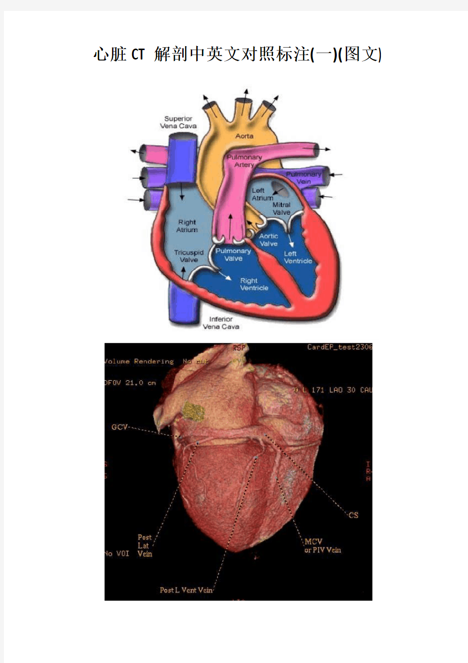 心脏CT解剖中英文对照标注