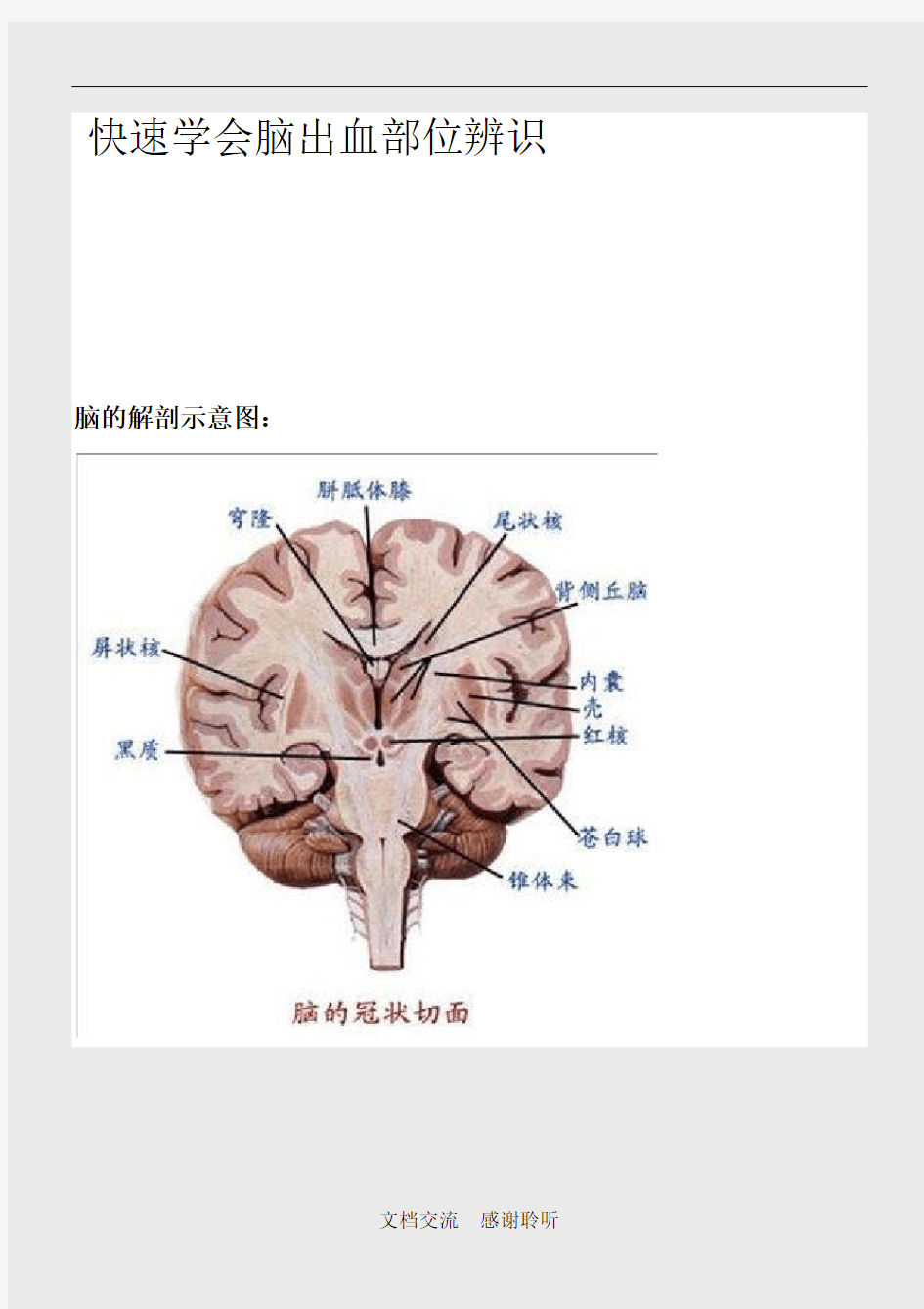 脑出血常见部位(建议收藏)