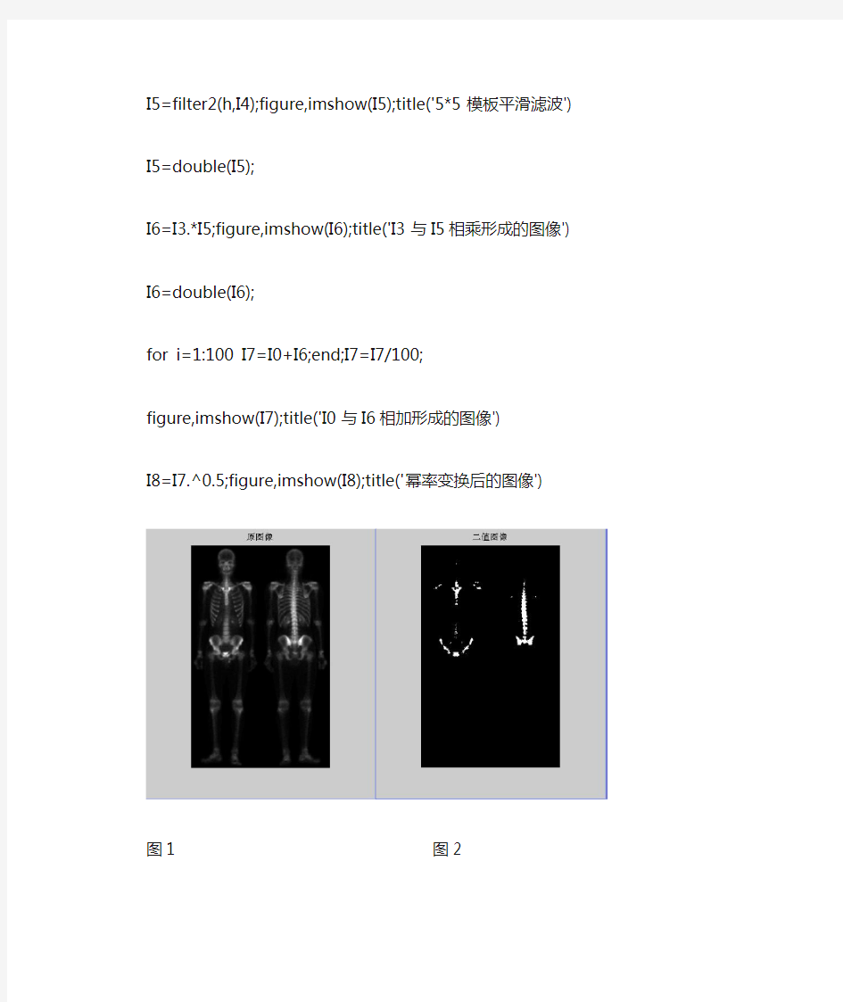 人体骨骼图像处理matlab程序