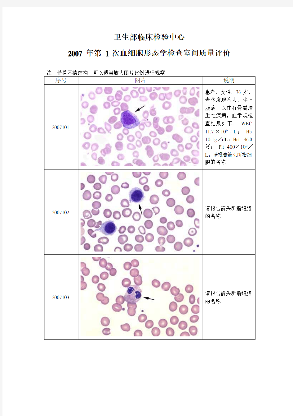 2007-2015年卫生部血细胞形态学检查室间质量评价