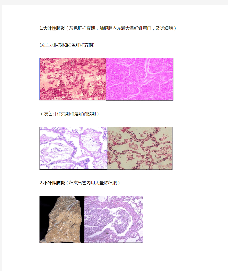 病理实验切片图片整理(第二部分)