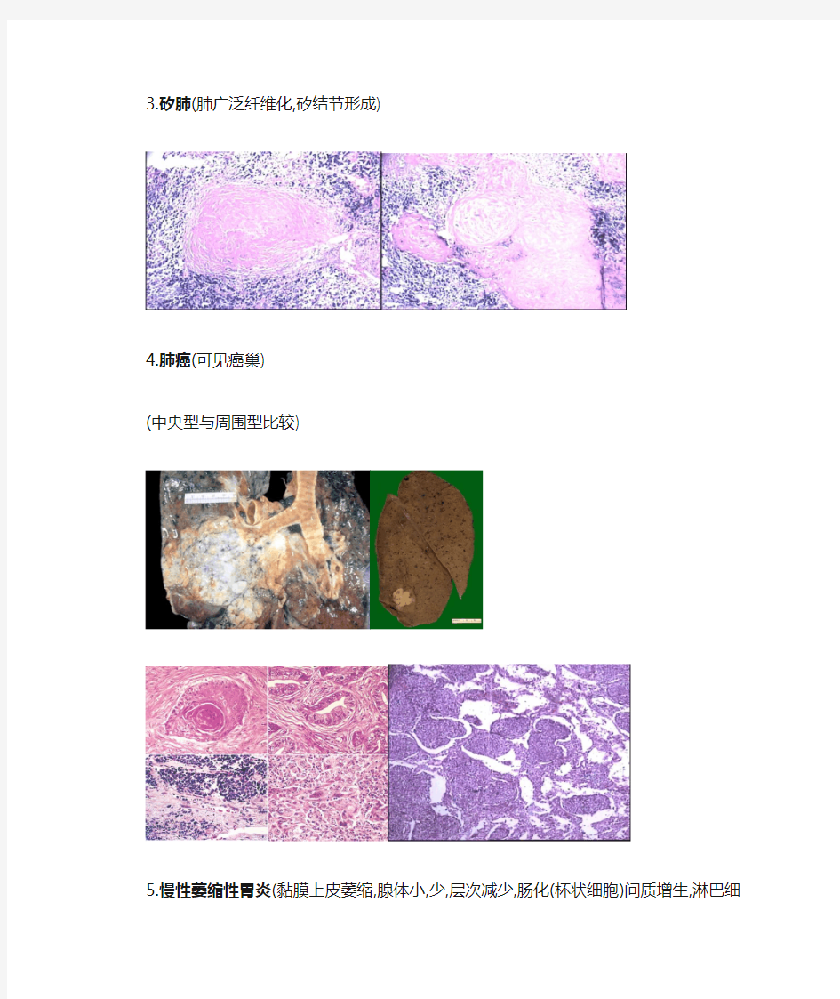 病理实验切片图片整理(第二部分)