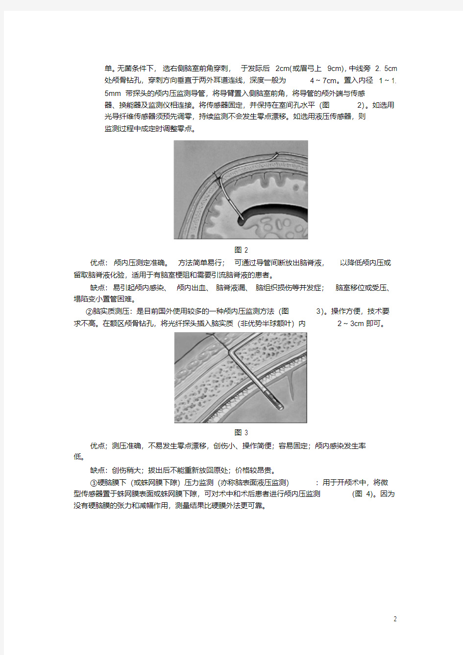 颅内压监测.pdf