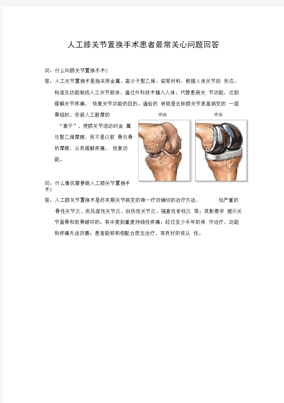 人工膝关节置换术宣教手册范本