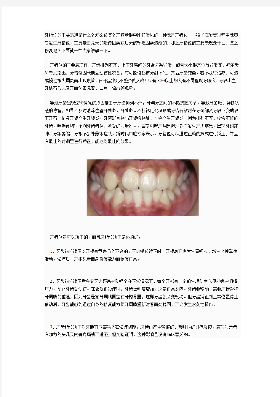 牙齿错位的具体表现及矫正解答