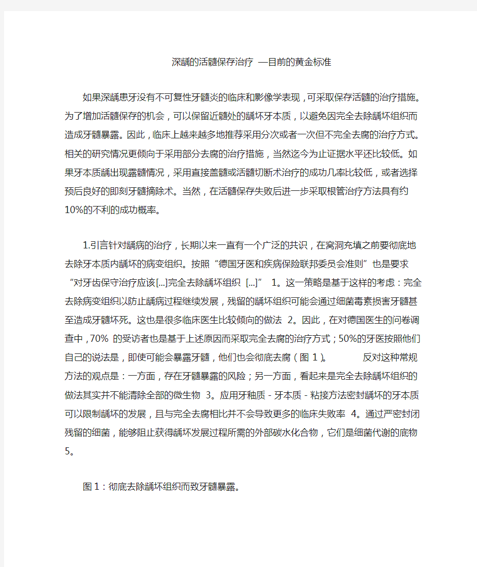 深龋的活髓保存治疗 目前的黄金标准