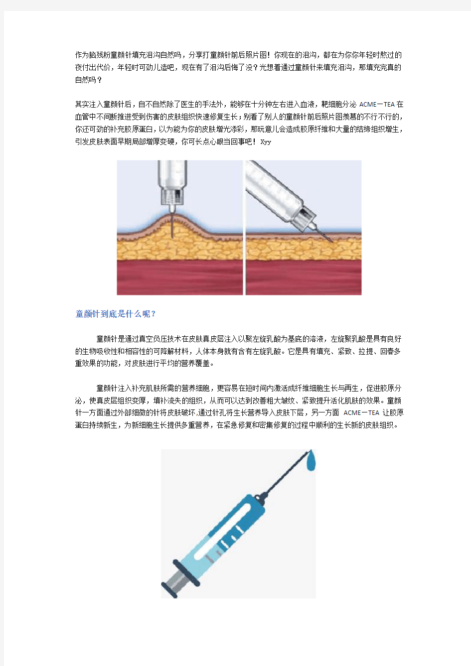 作为脑残粉童颜针填充泪沟自然吗,分享打童颜针前后照片图!