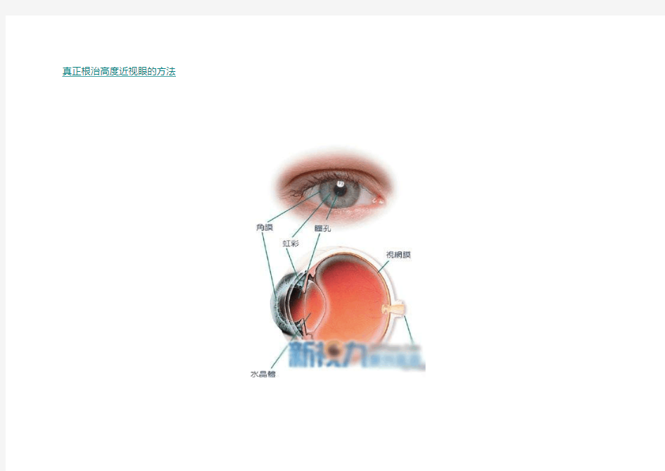 更治近视的最好方法
