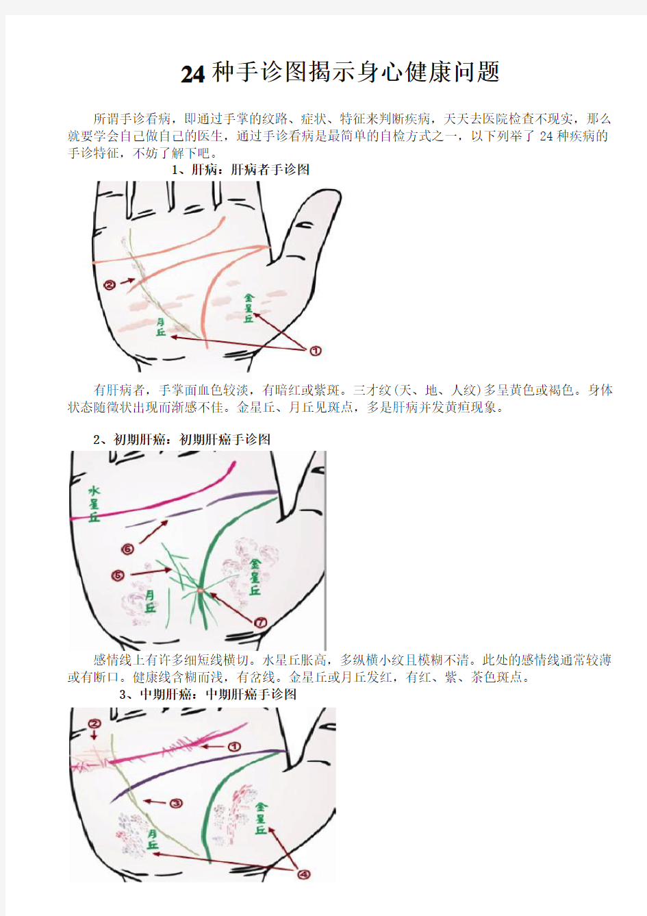 24种手诊图揭示身心健康问题