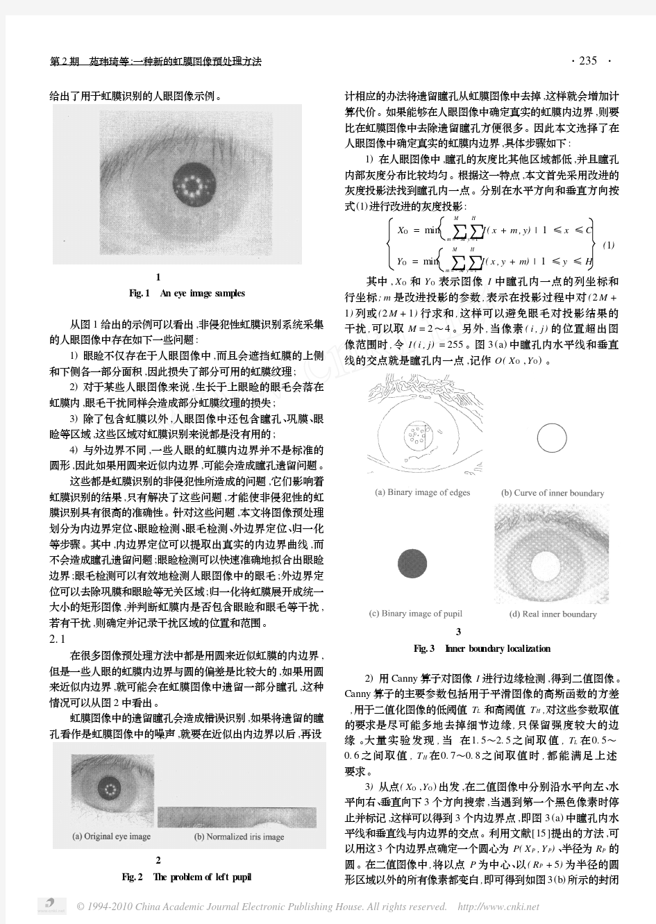 一种新的虹膜图像预处理方法