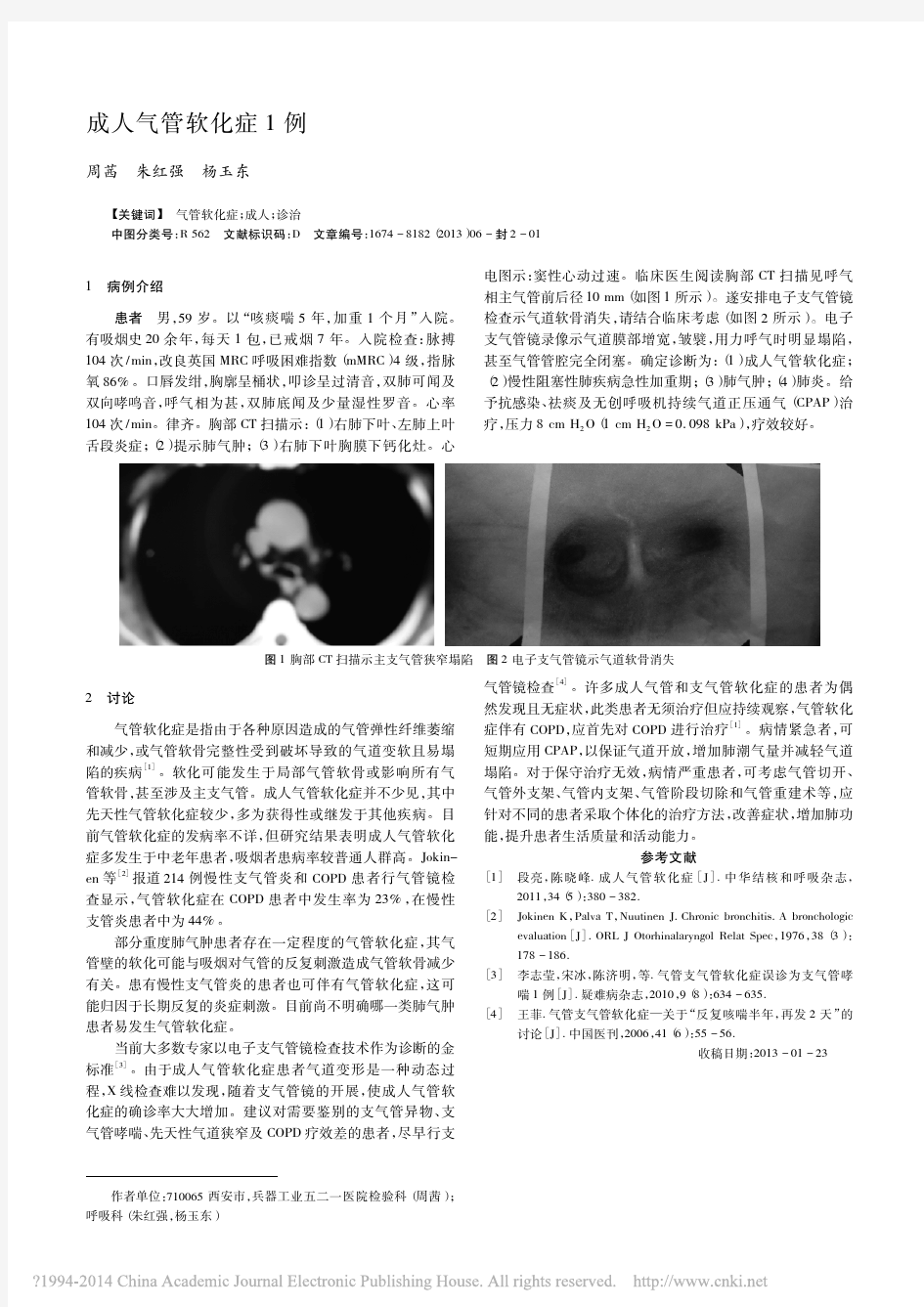 成人气管软化症1例