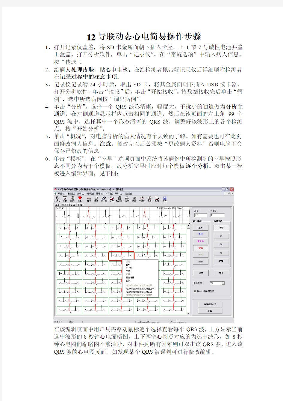 12导联动态心电简易操作步骤