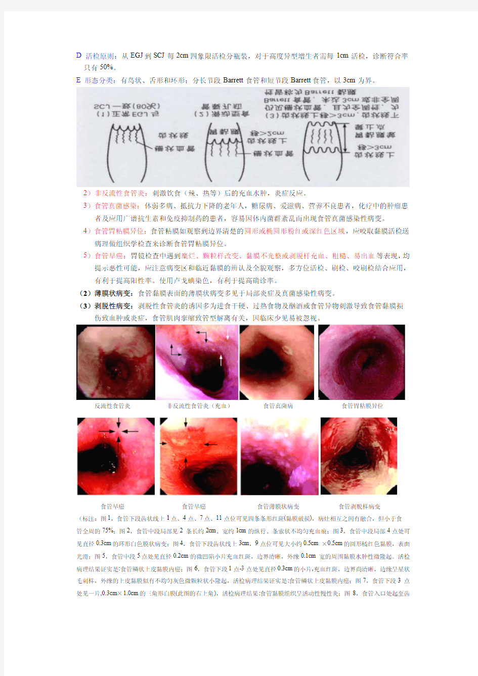 胃镜标准诊断术语之食管部分