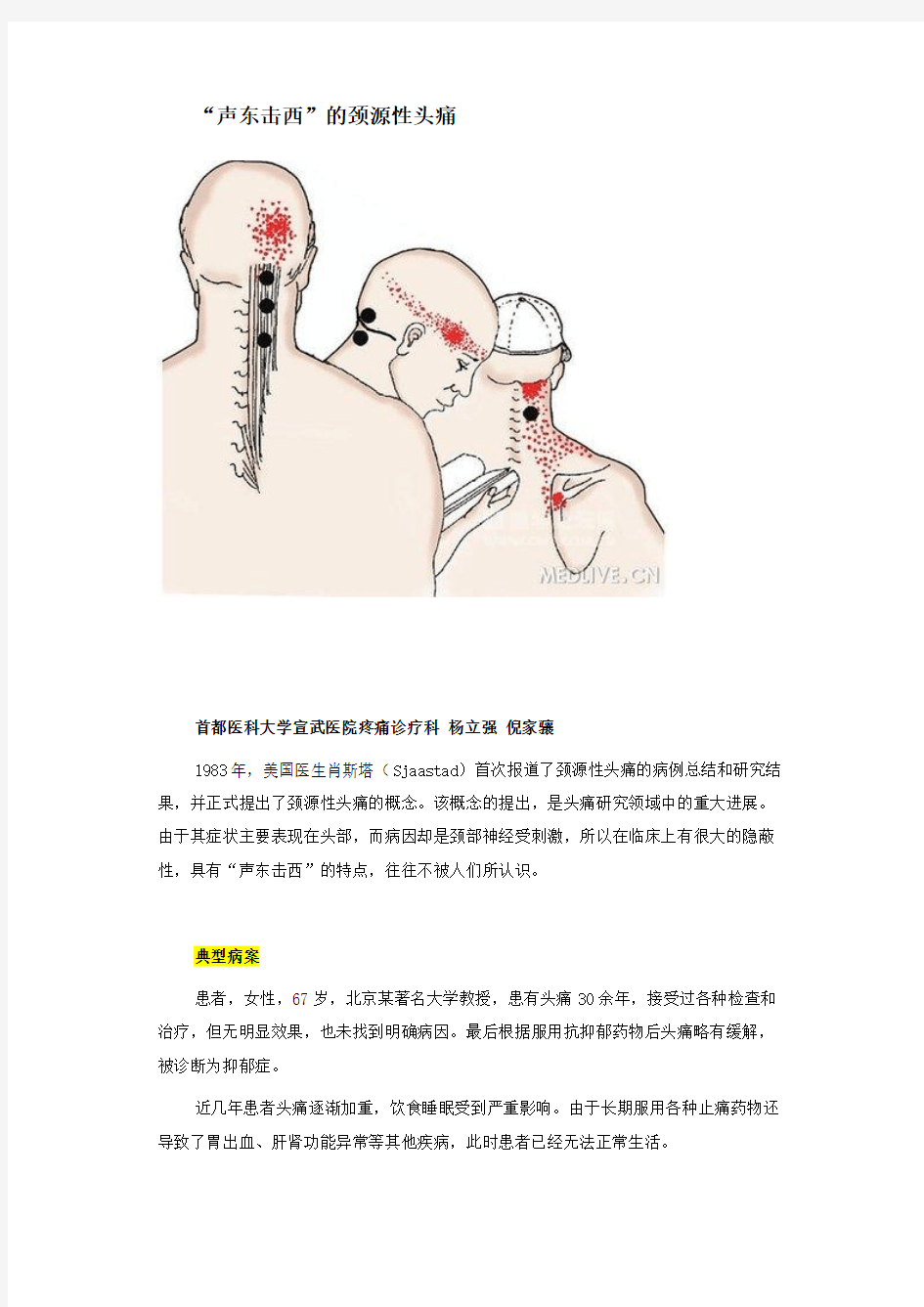 颈源性头痛