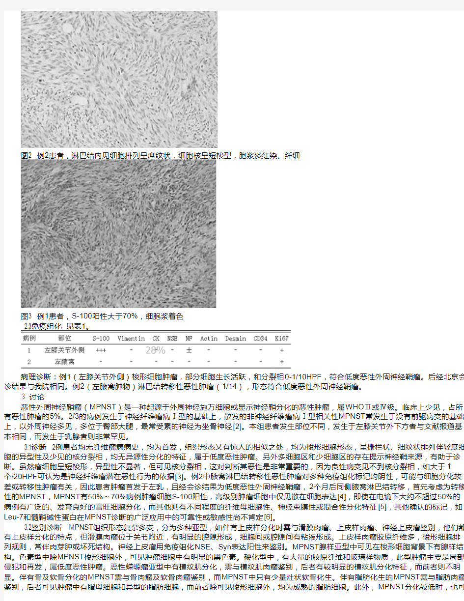 低度恶性外周神经鞘瘤临床病理观察