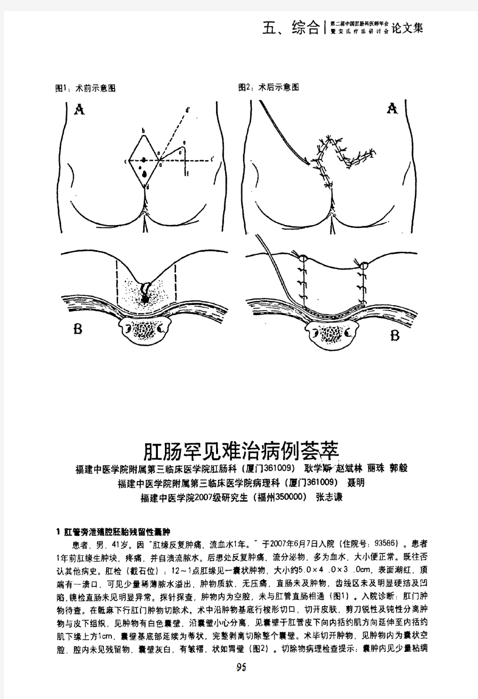 肛肠罕见难治病例荟萃