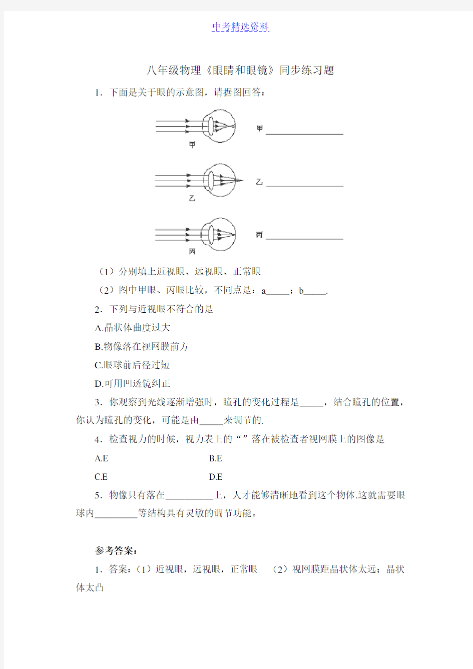 (完整版)初中物理眼睛和眼镜练习及答案