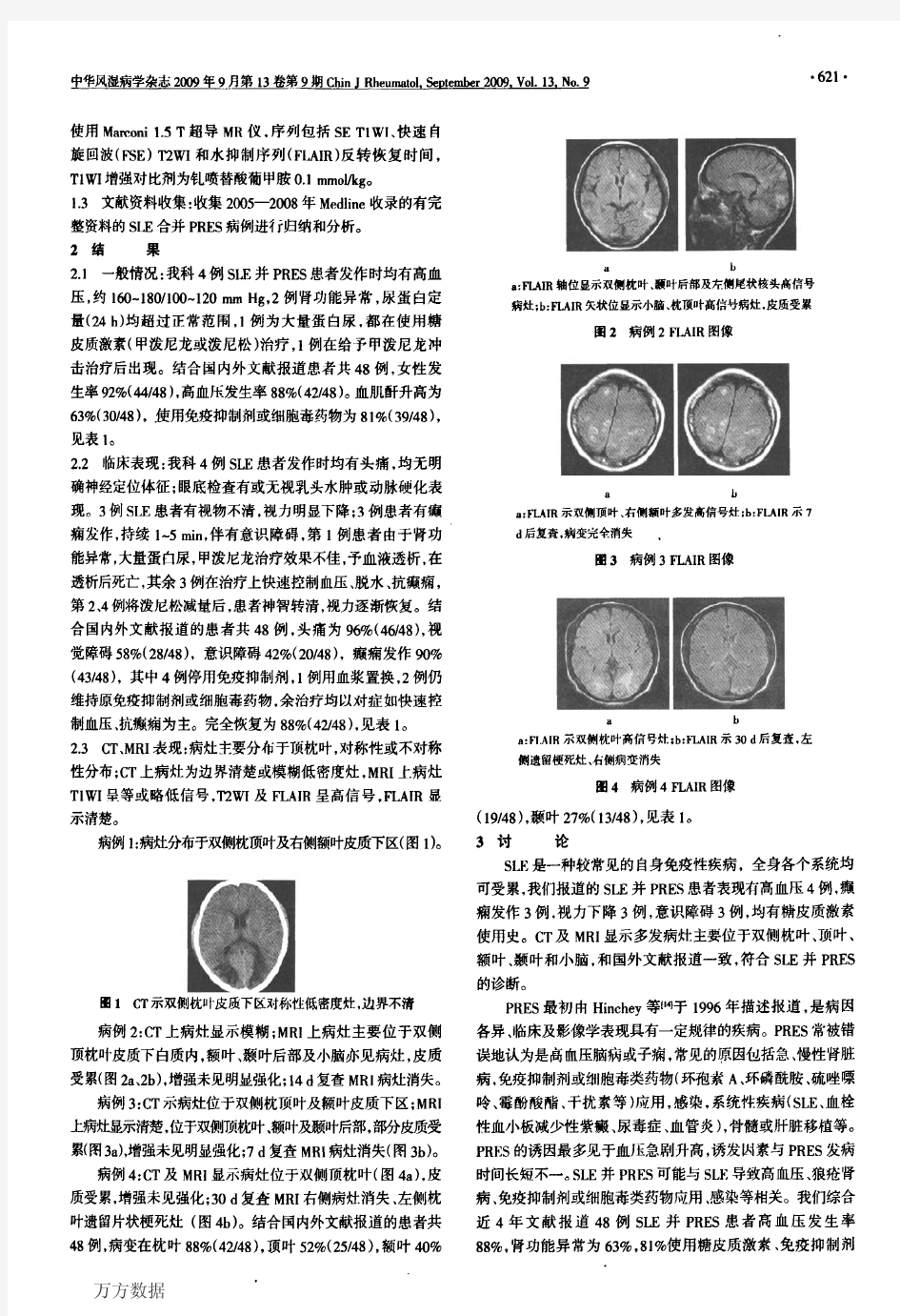 系统性红斑狼疮合并脑后部可逆性脑病综合征的临床分析