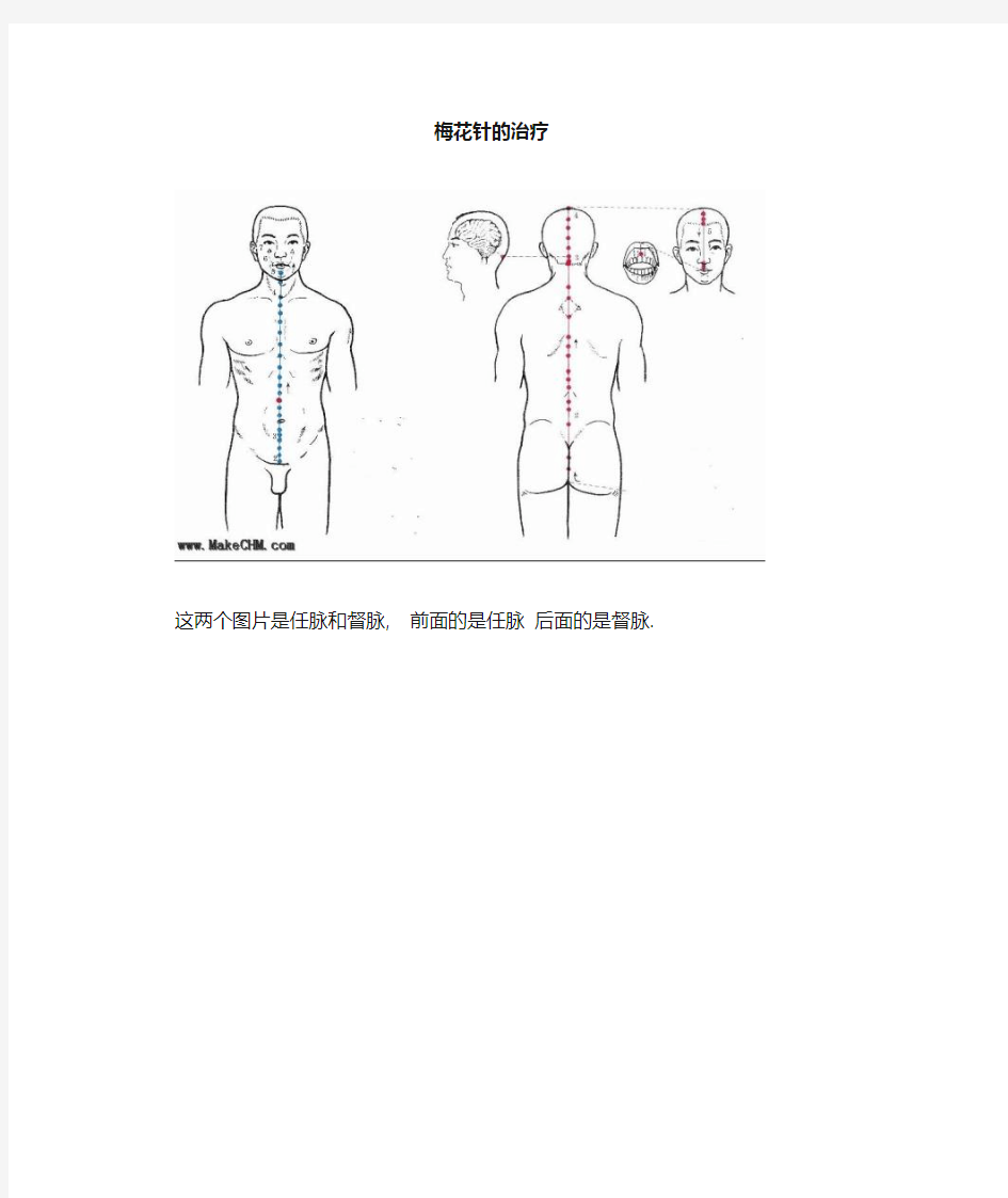 梅花针治疗