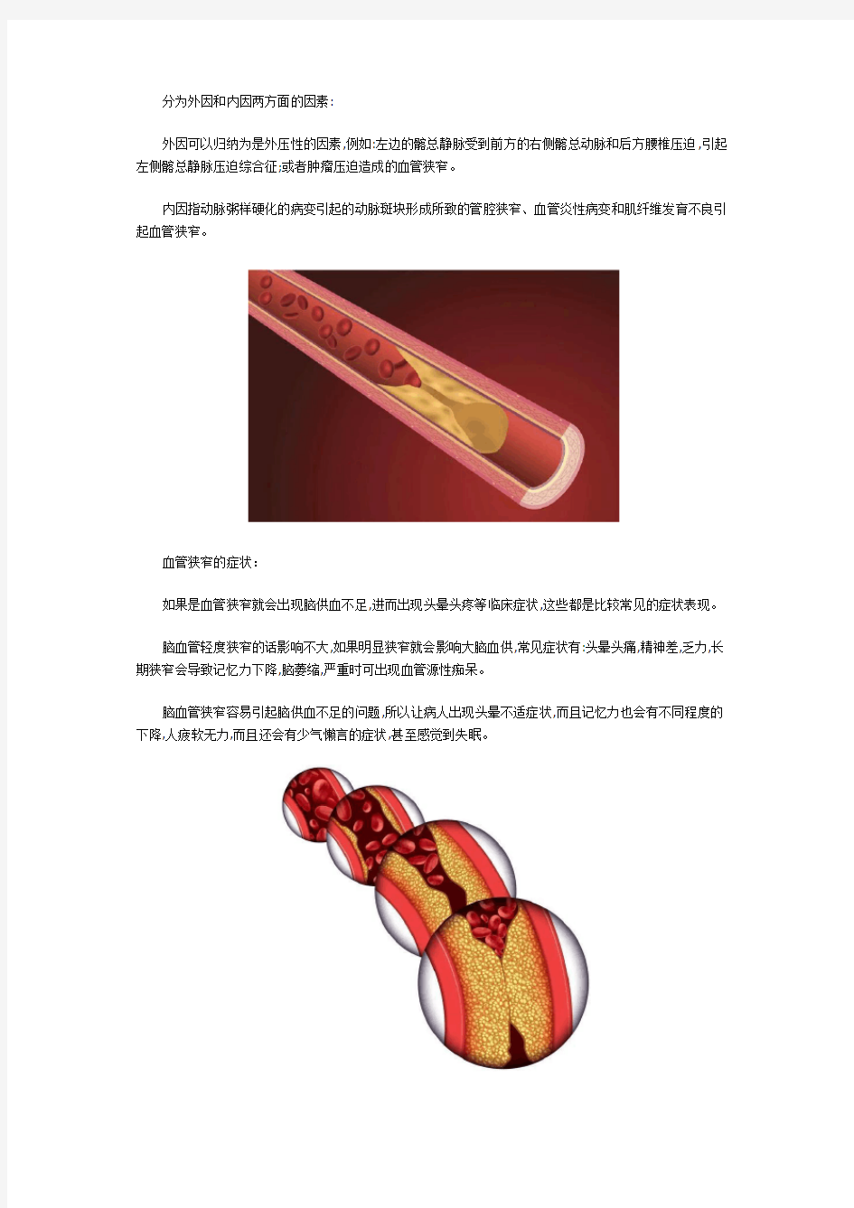 如何联系温吉焕医生：吃这6种食物,对老年人血管狭窄很有帮助