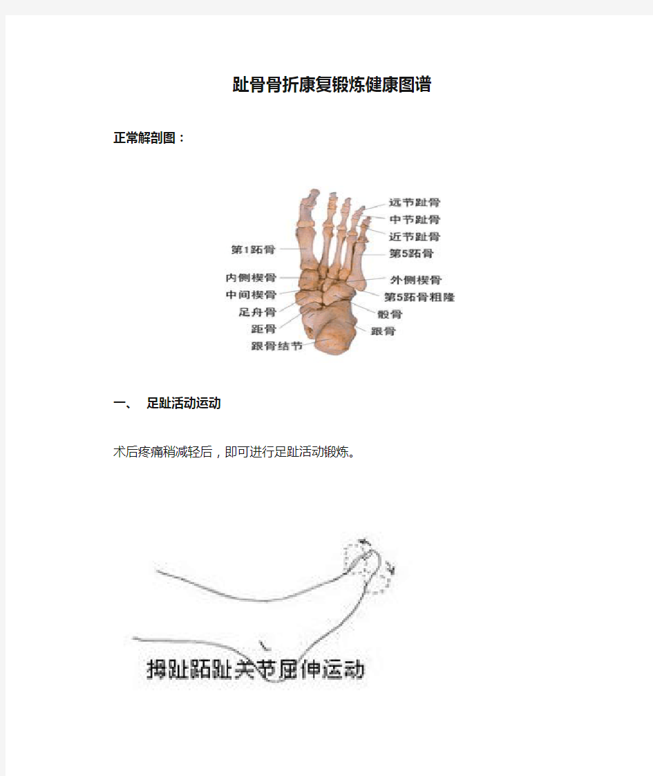 趾骨骨折康复锻炼健康图谱