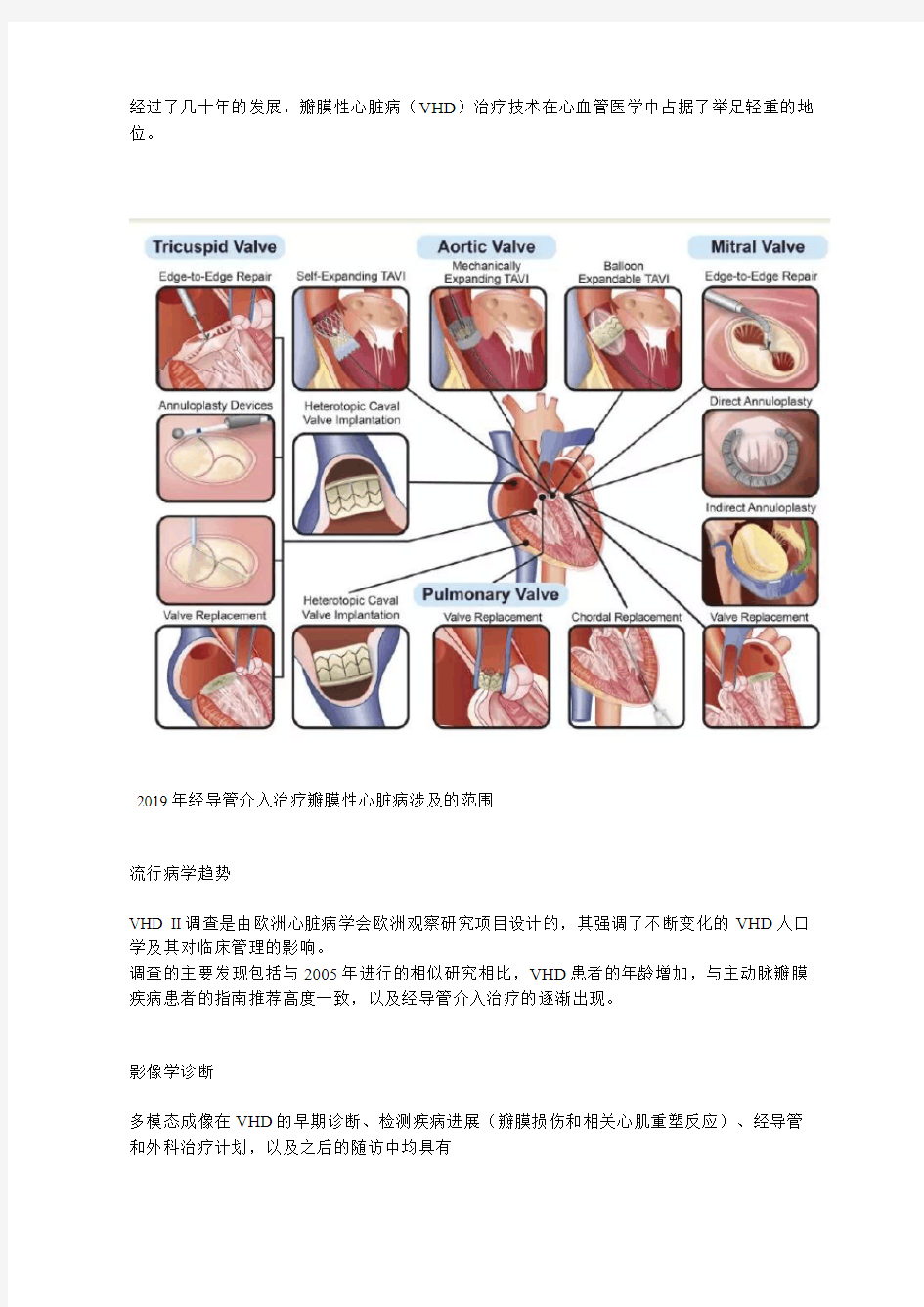 科学发现：瓣膜性心脏病治疗技术新进展