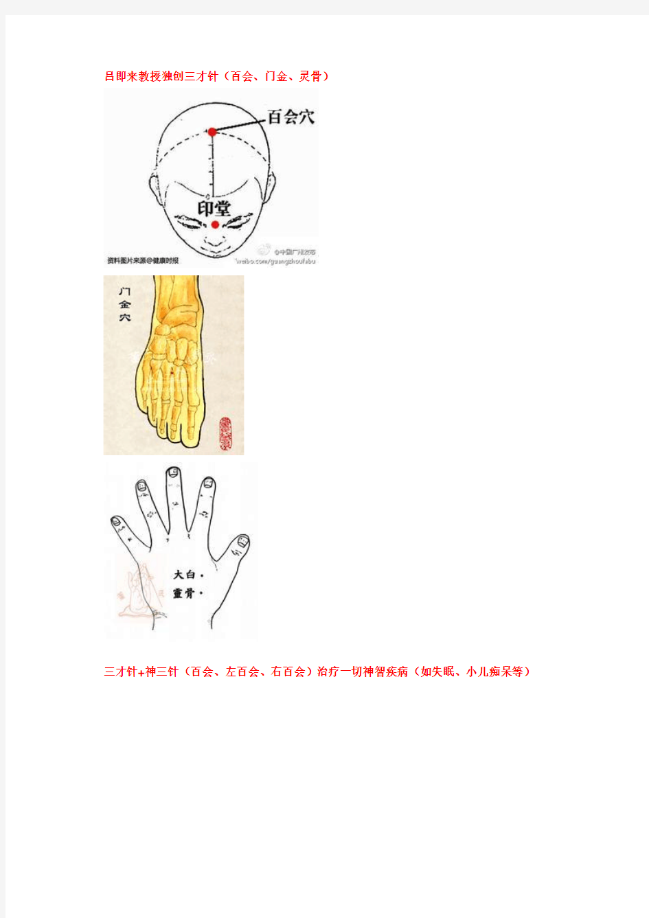 如何成为针灸高手