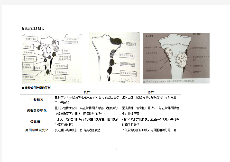 骨肿瘤鉴别诊断