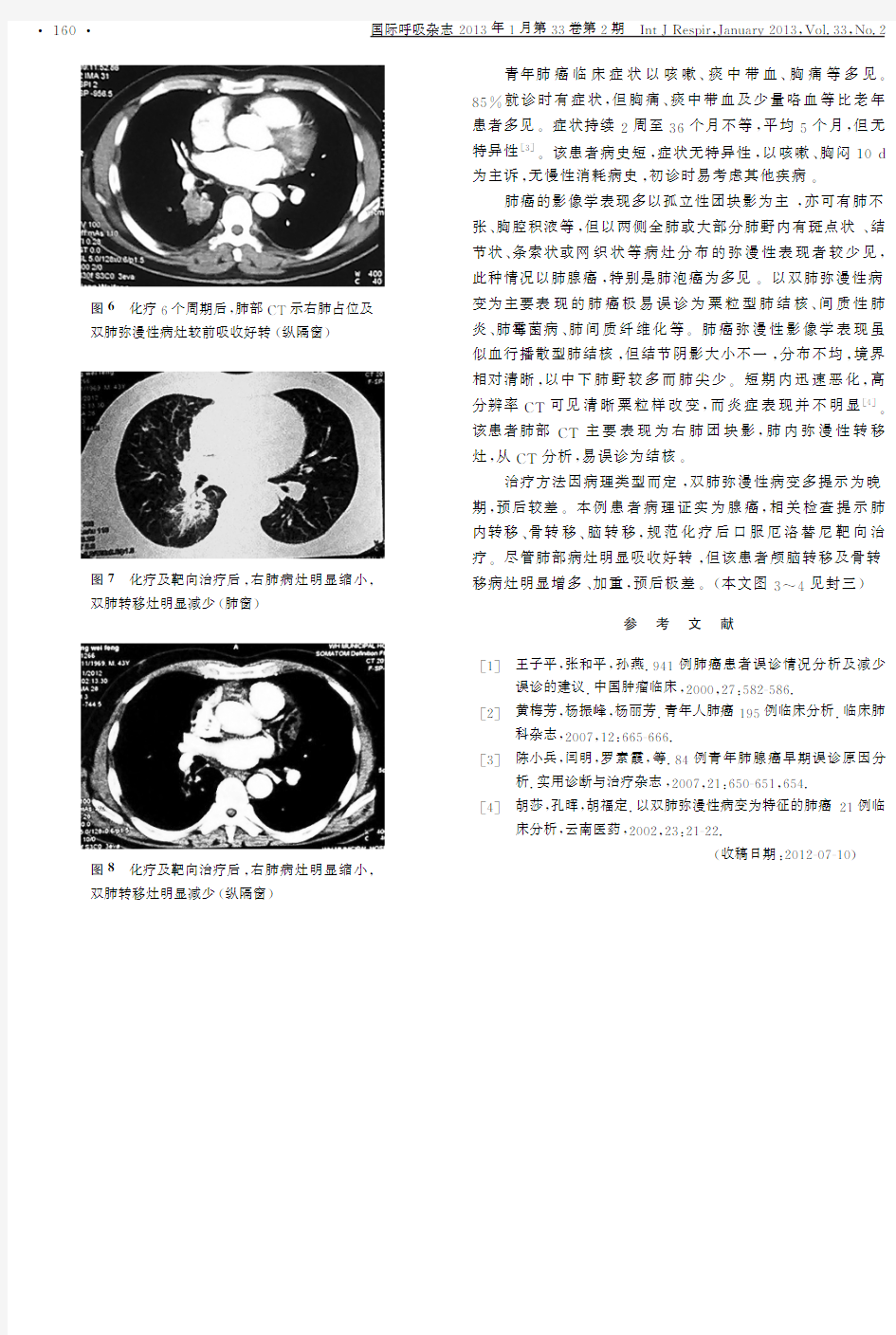 以双肺弥漫性病变为主要表现的青年肺癌1例