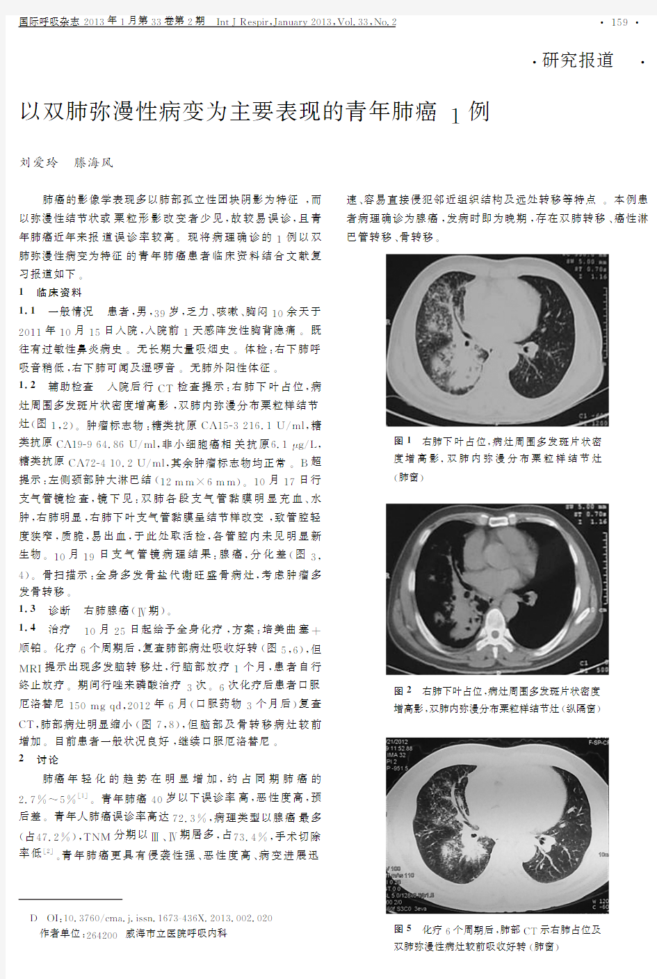 以双肺弥漫性病变为主要表现的青年肺癌1例