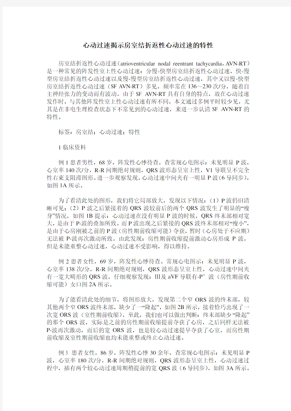 心动过速揭示房室结折返性心动过速的特性