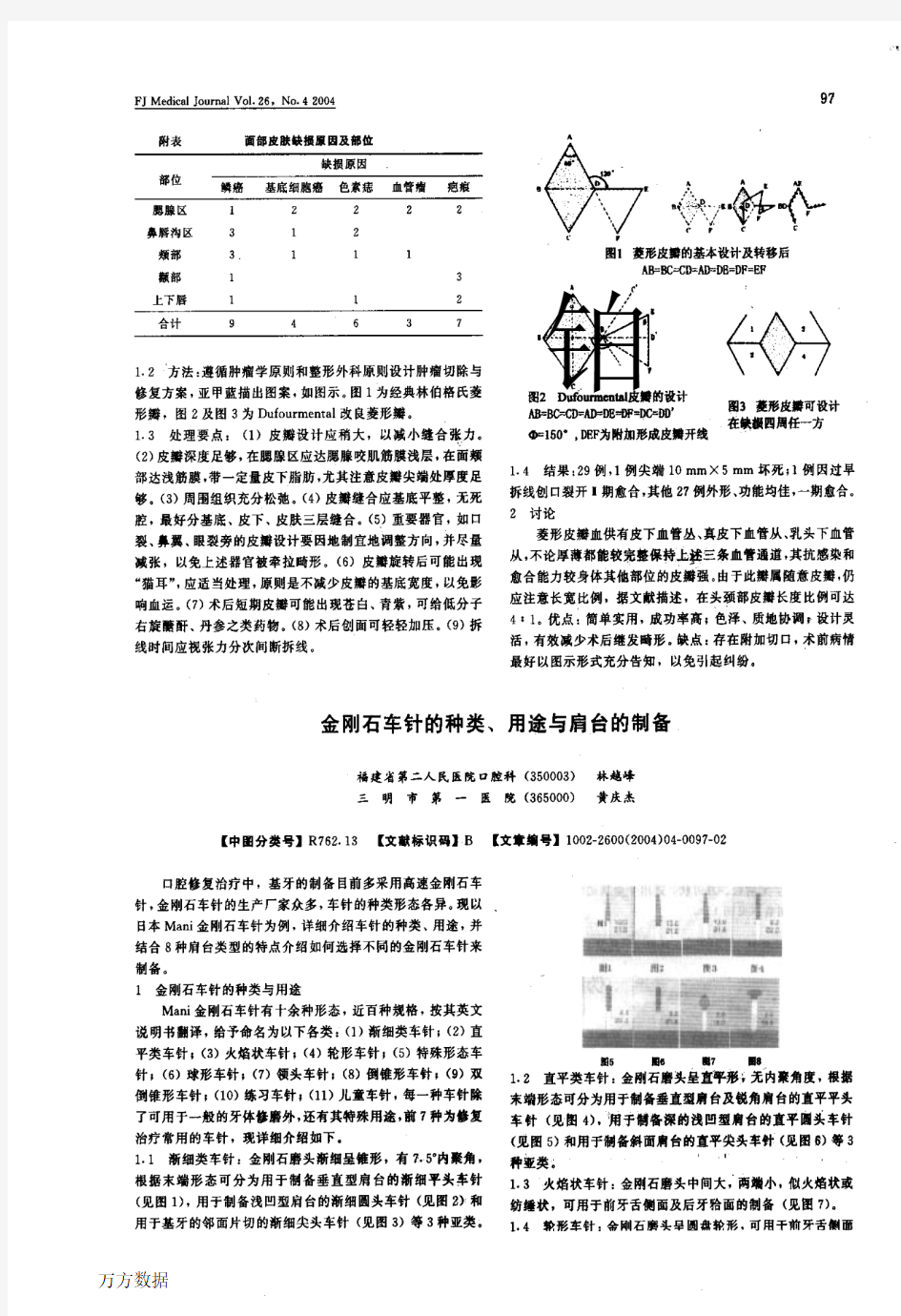 金刚石车针的种类、用途与肩台的制备