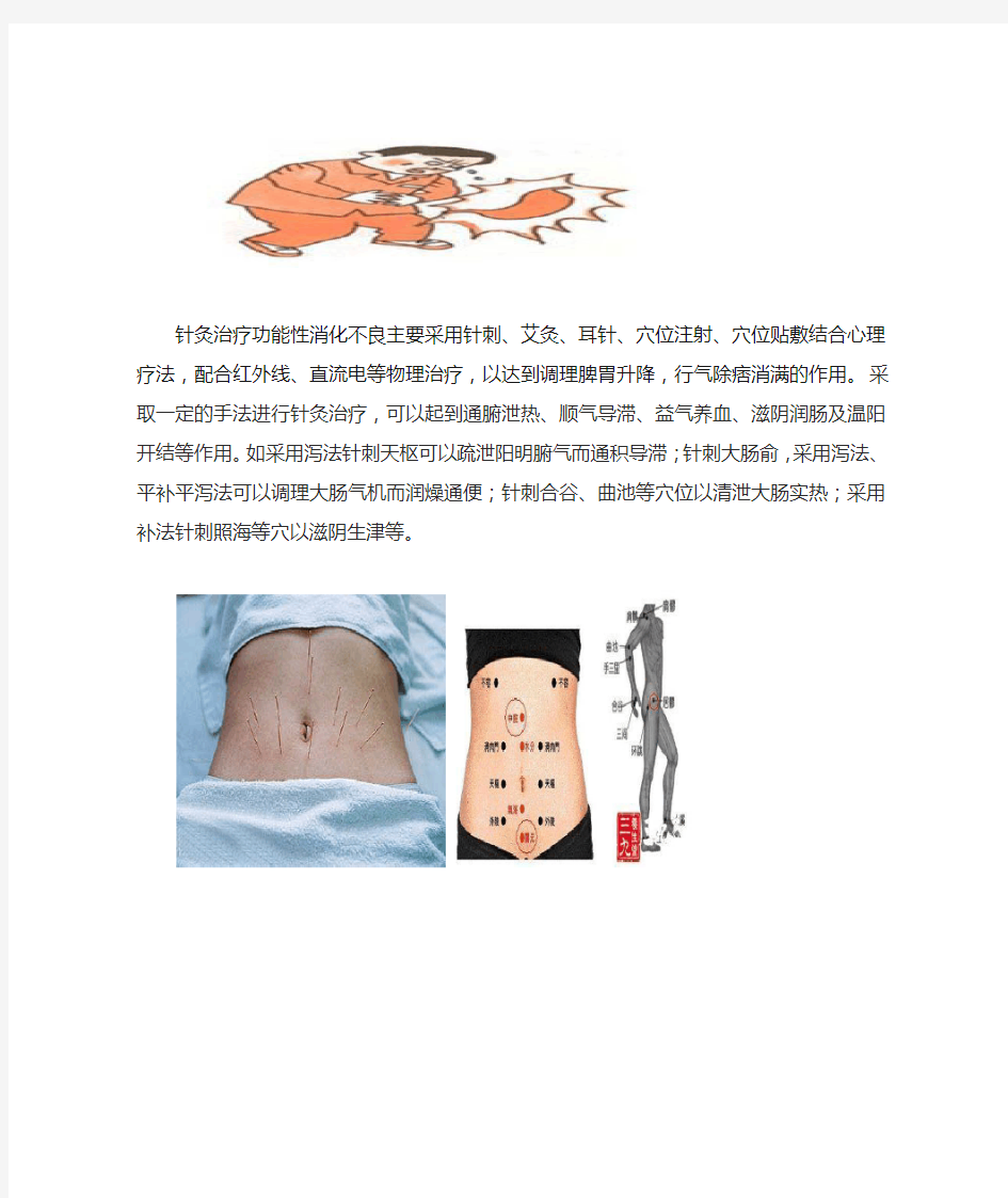 针灸治疗功能性消化不良