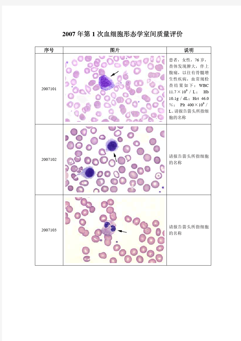 2007-2014年卫生部临检中心血细胞形态学检查室间质量评价(及答案)