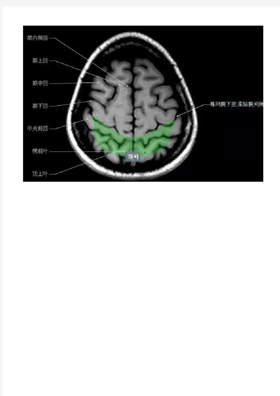 正常颅脑磁共振图示