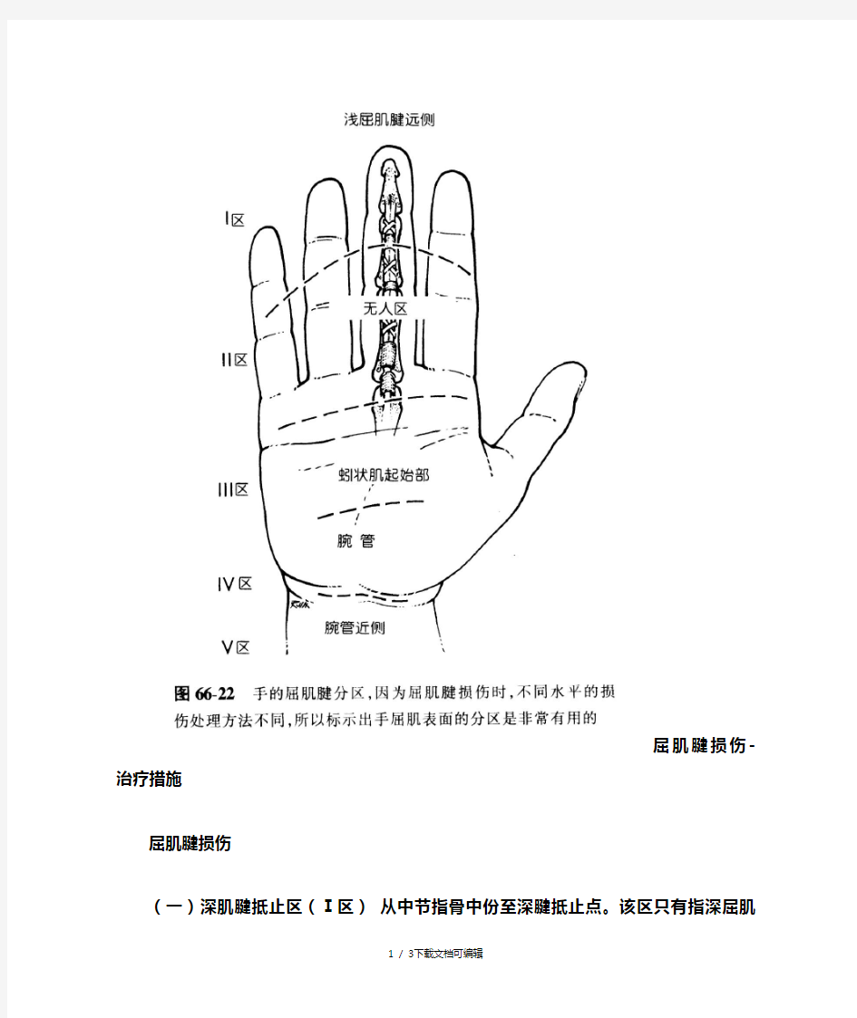 手屈肌腱分区及处理