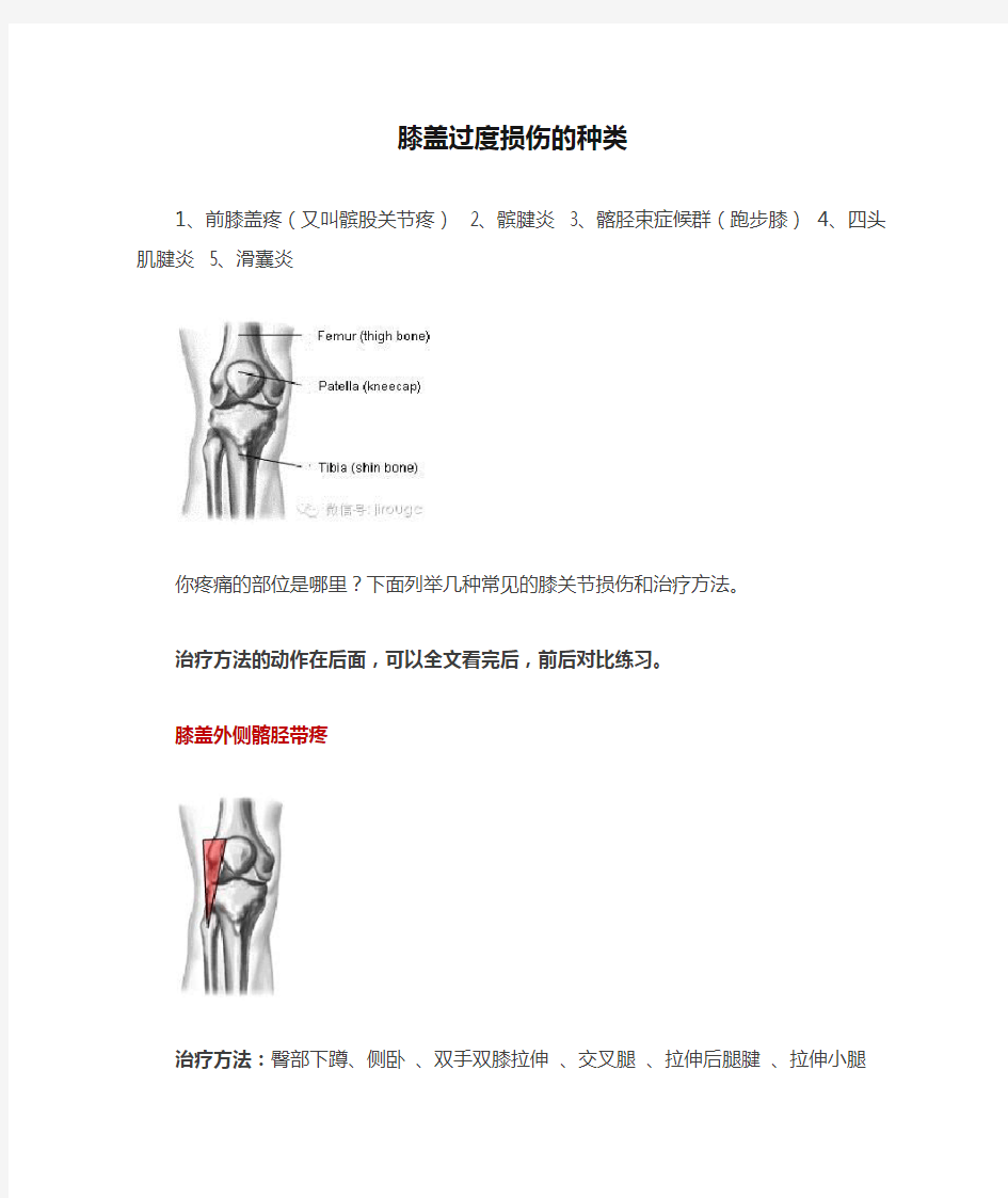 膝盖过度损伤的种类