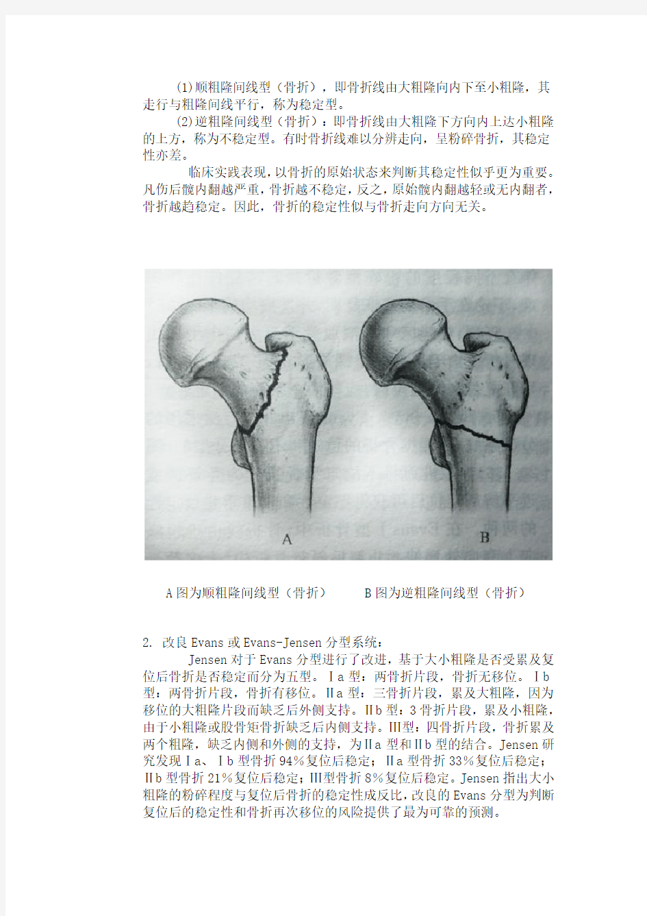 股骨粗隆间骨折(intertrochanteric fracture)