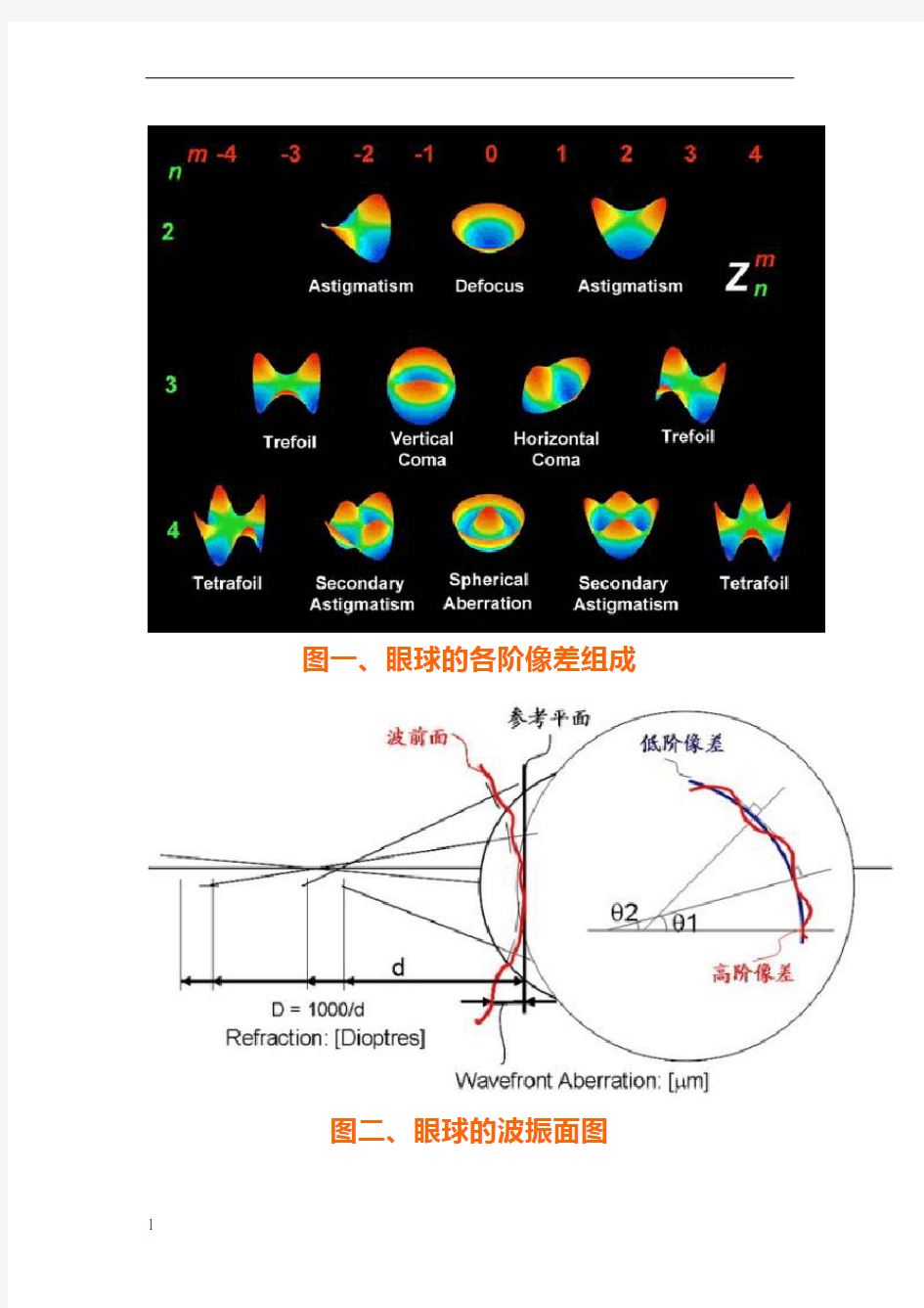 人眼的高阶与低阶像差来源