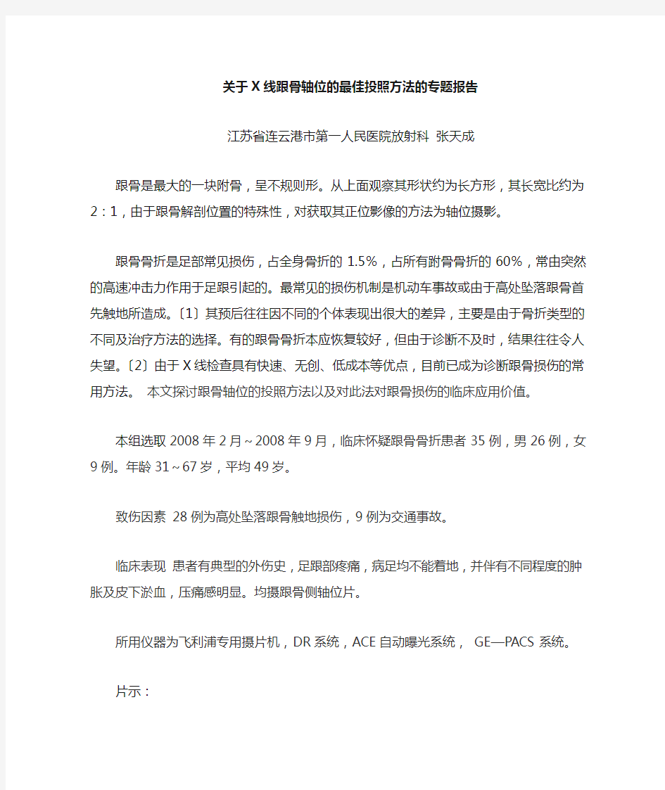 X线跟骨轴位的最佳投照方法以及对跟骨骨折临床诊断的价值